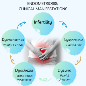Understanding Endometriosis: Unveiling the Common Symptoms and Their Impact