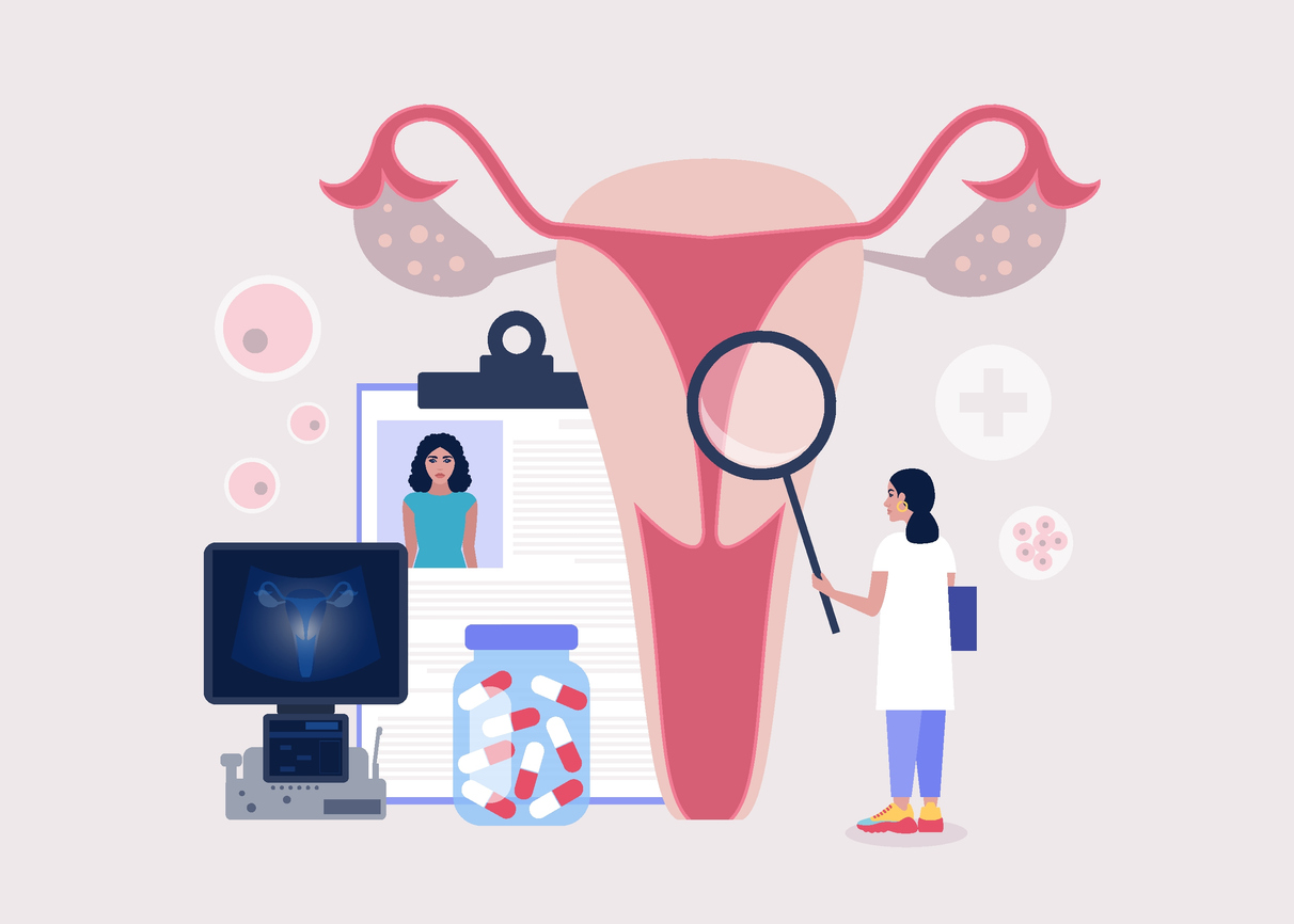 Endometriosis - iCareBetter