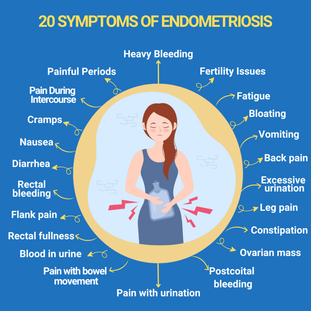 20 Symptoms of Endometriosis